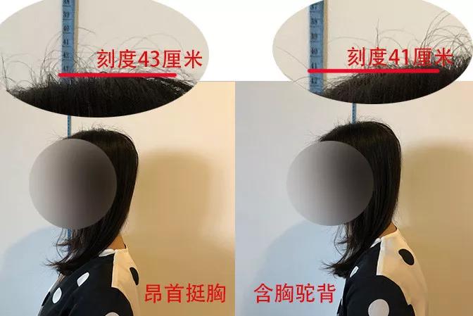 你可能也變得脖子前傾、含胸駝背了